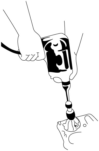 エンジンのシリンダー内のスラッジ除去に。