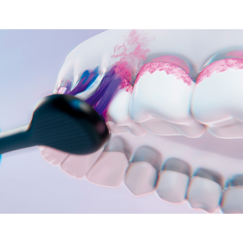 ヨコ方向への細かなリニア音波振動で、歯周ポケットに潜む、歯周病の原因プラークをかき出します