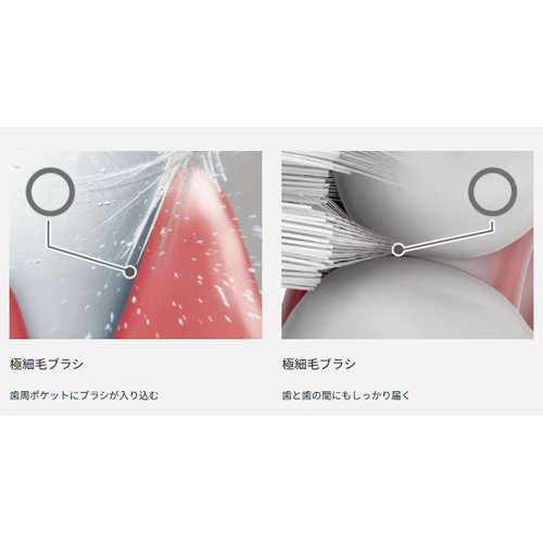 先端細さ約0.02mmの極細毛ブラシが、歯周ポケット・歯間などの細かいすき間までしっかり届きます