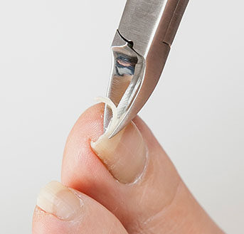 ★爪中央から切れるので、巻き爪の原因となる、角の切りすぎや深爪を防ぎます。